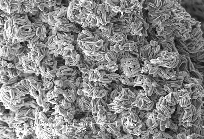 provo anch''io con la microscopia ......elettronica