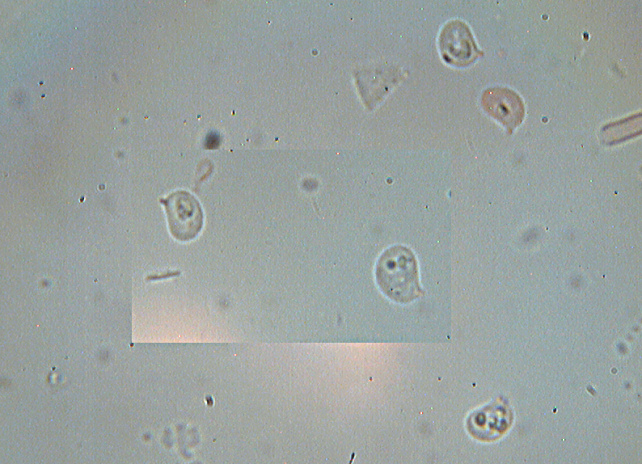 Le basidiospore negli Aphyllophorales