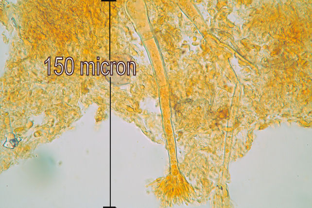 Phlebia subochracea