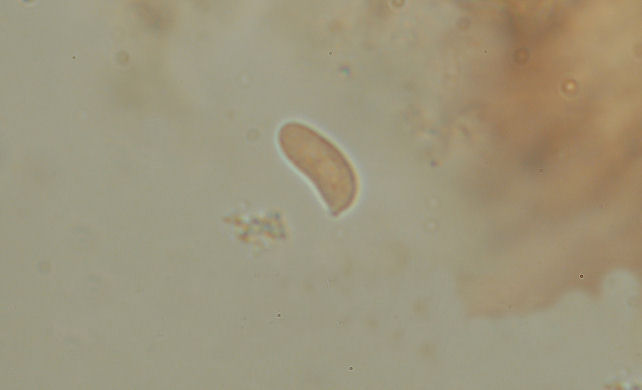 Le basidiospore negli Aphyllophorales