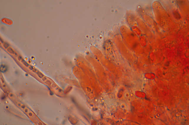 Una rara polyporacea: Parmastomyces mollissimus