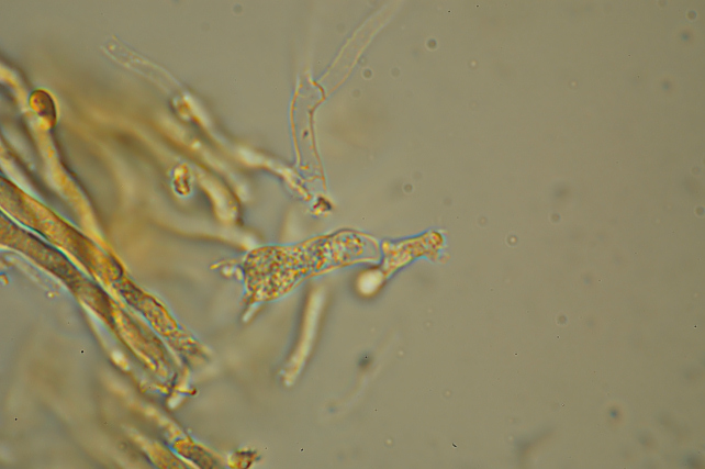 Una rara polyporacea: Parmastomyces mollissimus