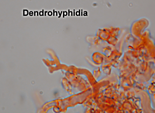 Aphyllophorales???