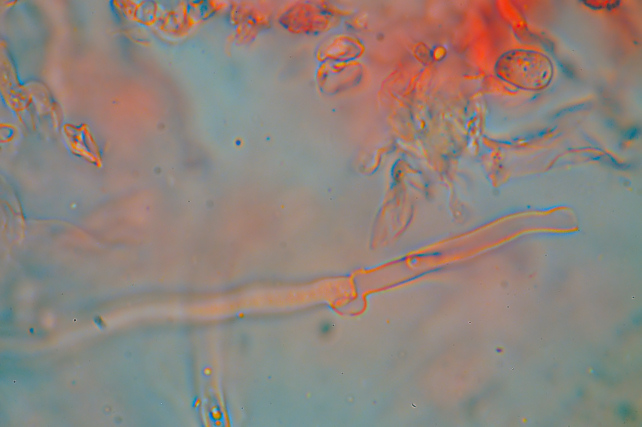 Corticiaceae da determinare... (Radulomyces molaris)