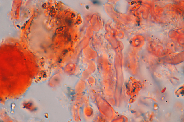 Quale Antrodia? (Antrodia albida)