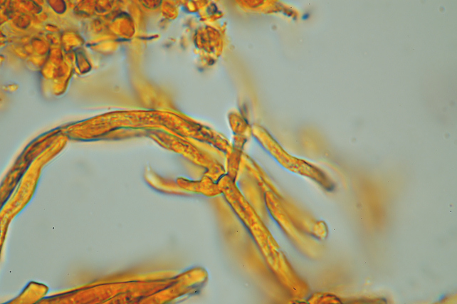 Una rara polyporacea: Parmastomyces mollissimus