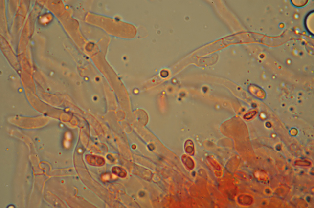 Una rara polyporacea: Parmastomyces mollissimus