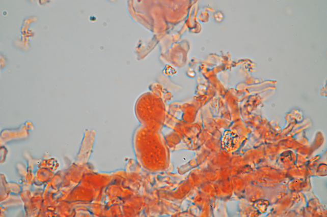 Aphyllophorales???