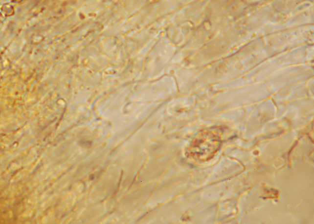 Phlebia subochracea