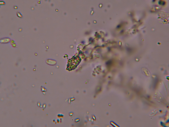 Phlebia subochracea