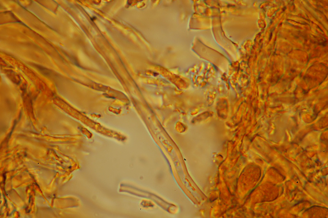 Aphyllophorales???