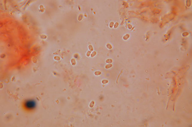 Phlebia subochracea