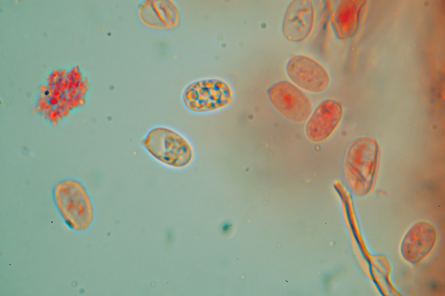Corticiaceae da determinare... (Radulomyces molaris)