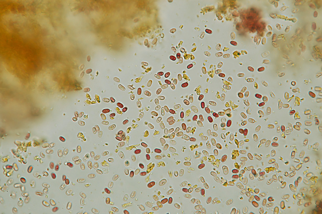 Una rara polyporacea: Parmastomyces mollissimus