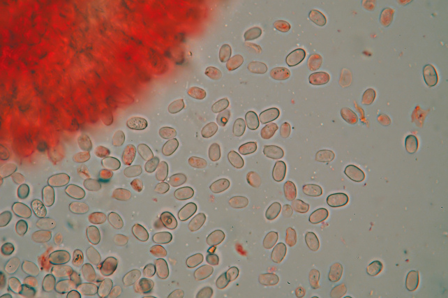 Corticiaceae da determinare... (Radulomyces molaris)