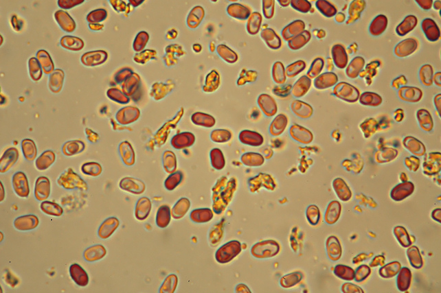 Una rara polyporacea: Parmastomyces mollissimus