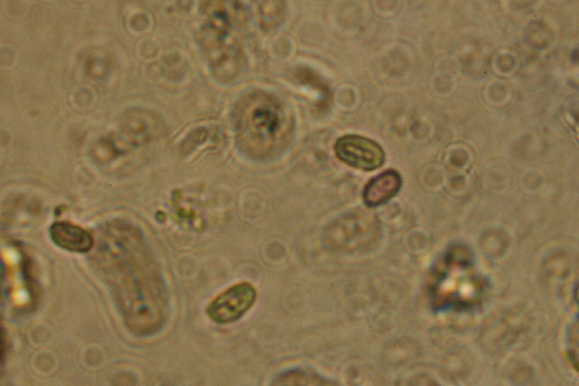 questo non lo conosco proprio!! (Parmastomyces mollissimus)