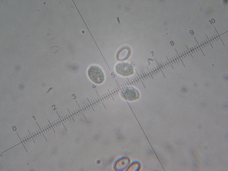 Melanoleuca exscissa ?