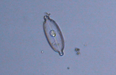 Microscopia a Torre Flavia (Ladispoli)