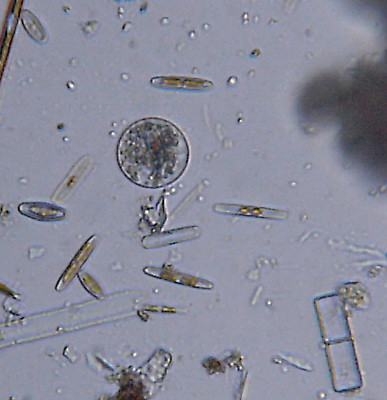 Microscopia al Lago di Bracciano, zona Pantane