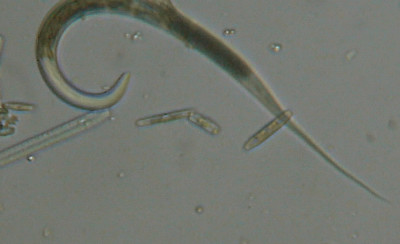 Microscopia al Lago di Bracciano, zona Pantane