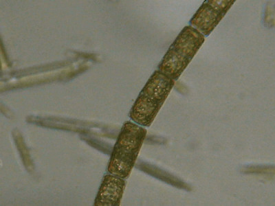 Microscopia al Lago di Bracciano, zona Pantane
