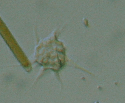 Microscopia al Lago di Bracciano, zona Pantane