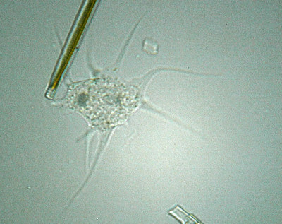 Microscopia al Lago di Bracciano, zona Pantane