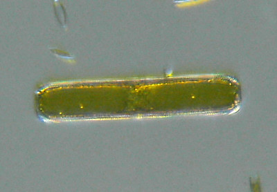 Microscopia al Lago di Bracciano, zona Pantane