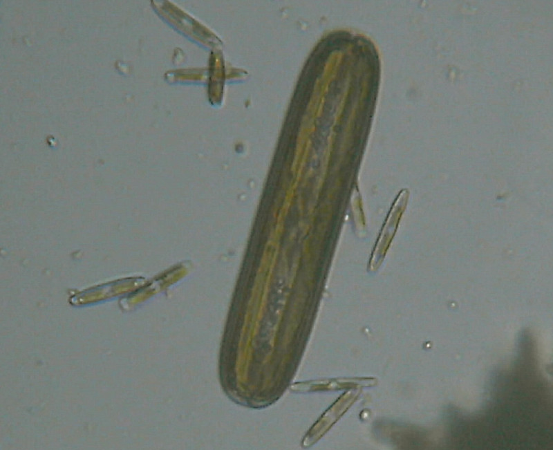 Microscopia al Lago di Bracciano, zona Pantane