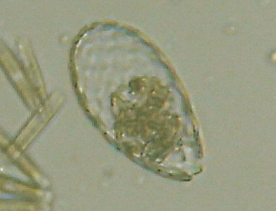 Microscopia al Lago di Bracciano, zona Pantane