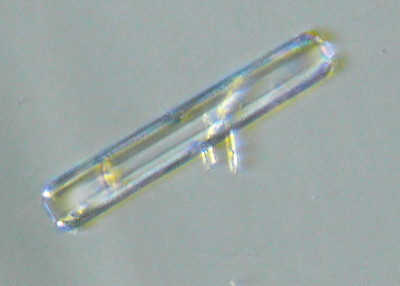 Microscopia al Lago di Bracciano, zona Pantane