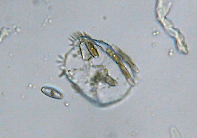 Microscopia al Lago di Bracciano, zona Pantane