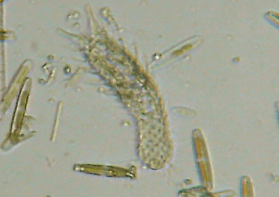Microscopia al Lago di Bracciano, zona Pantane