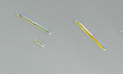 Microscopia al Lago di Bracciano, zona Pantane
