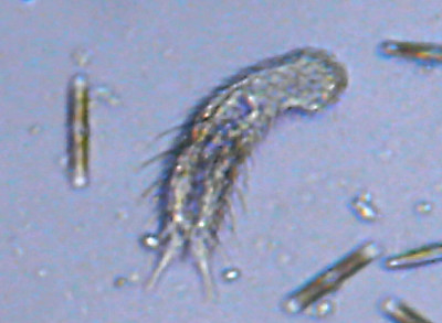 Microscopia al Lago di Bracciano, zona Pantane