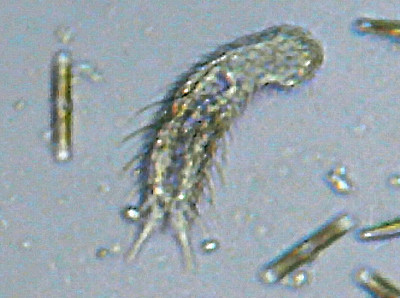 Microscopia al Lago di Bracciano, zona Pantane