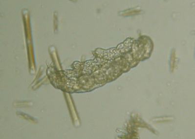 Microscopia al Lago di Bracciano, zona Pantane
