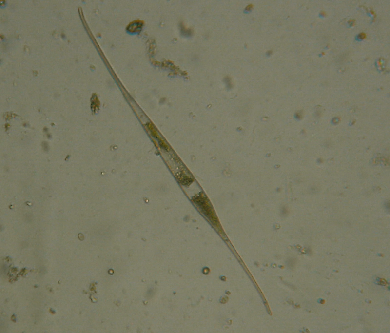 Microscopia delle acque astatiche del Bosco di Foglino