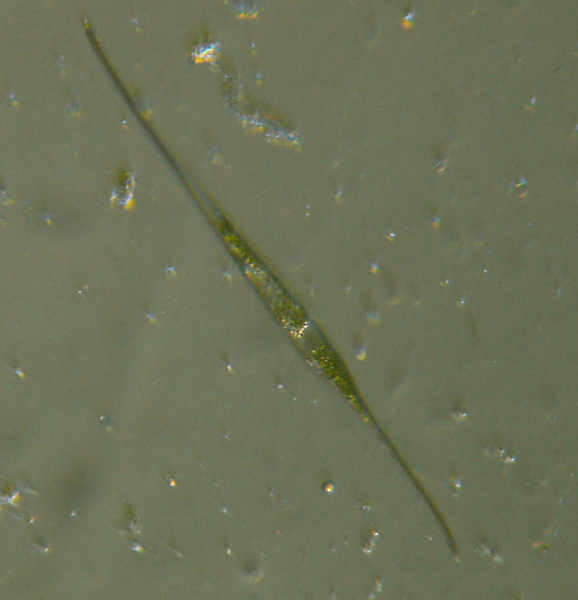 Microscopia delle acque astatiche del Bosco di Foglino