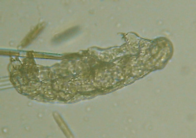 Microscopia al Lago di Bracciano, zona Pantane