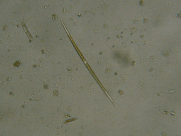 Microscopia delle acque astatiche del Bosco di Foglino