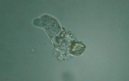 Microscopia delle acque astatiche del Bosco di Foglino