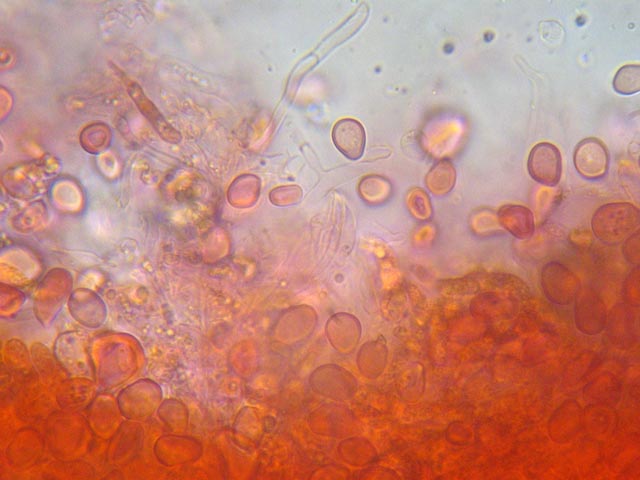 Sphaerobolus stellatus