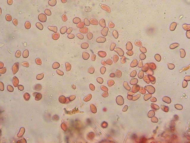 Sphaerobolus stellatus