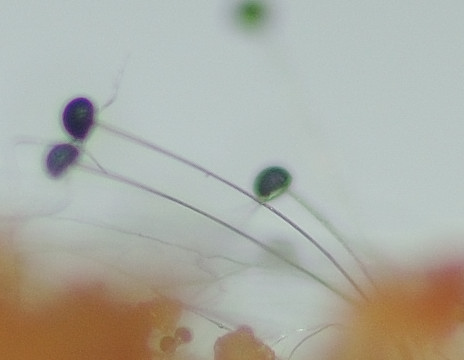 La muffa del pane Aspergillus niger