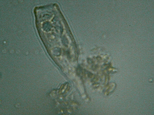 Microscopia delle acque astatiche del Bosco di Foglino