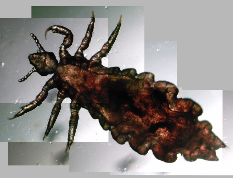 Ospite inatteso (ed indesiderato!): Pediculus humanus