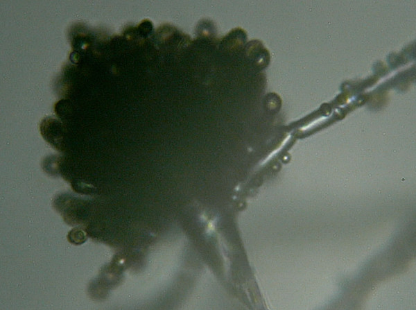 La muffa del pane Aspergillus niger