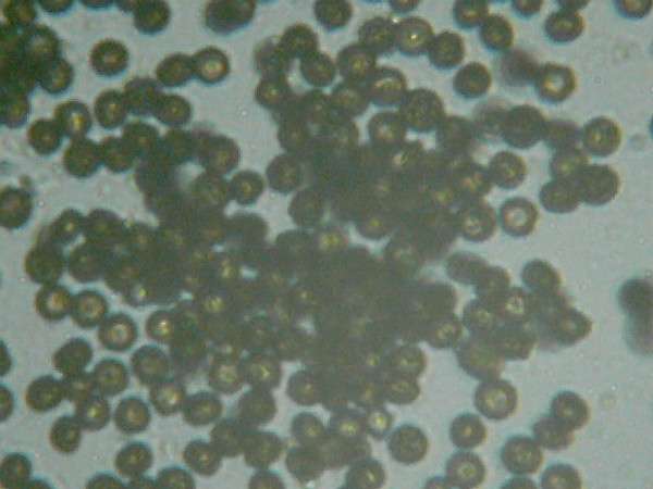 La muffa del pane Aspergillus niger